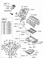 Pan assy - engine oil, upper 215203C151 HYUNDAI